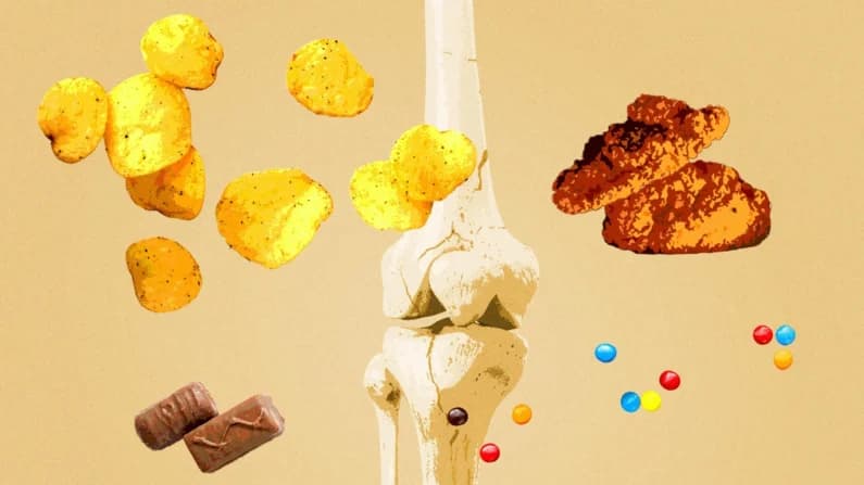 Relacionan alimentos ultraprocesados con huesos más débiles y mayor riesgo de fracturas: estudio