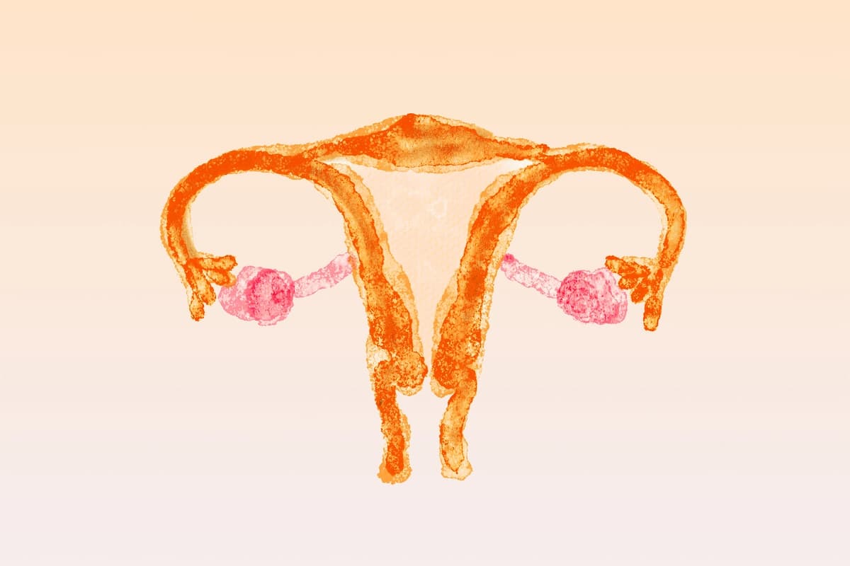 Útero y ovarios enfrentan diferentes malformaciones que podrían tardar en diagnosticar. (Ilustración de The Epoch Times, Getty Images).