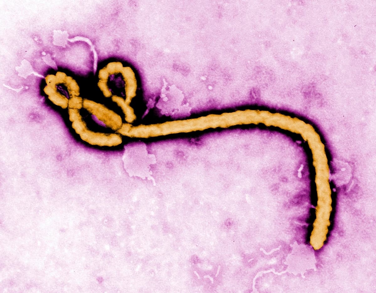 Esta micrografía electrónica de transmisión coloreada, sin fecha, proporcionada por los Centros para el Control y la Prevención de Enfermedades (CDC), muestra un virión del virus del Ébola. (Frederick Murphy/CDC vía AP, Archivo).