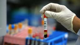 Sociedad Americana contra el Cáncer dice que análisis de sangre es una opción para el cáncer de colon y recto