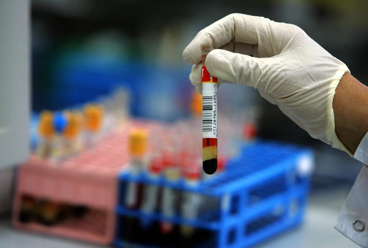 Una fotografía de archivo sin fecha muestra a un técnico de laboratorio recogiendo un tubo de ensayo con una muestra de sangre humana. David (Silverman/Getty Images)
