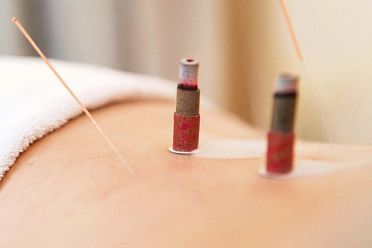 La medicina tradicional china en la insuficiencia ovárica prematura. (Colorsandia/Getty Images).