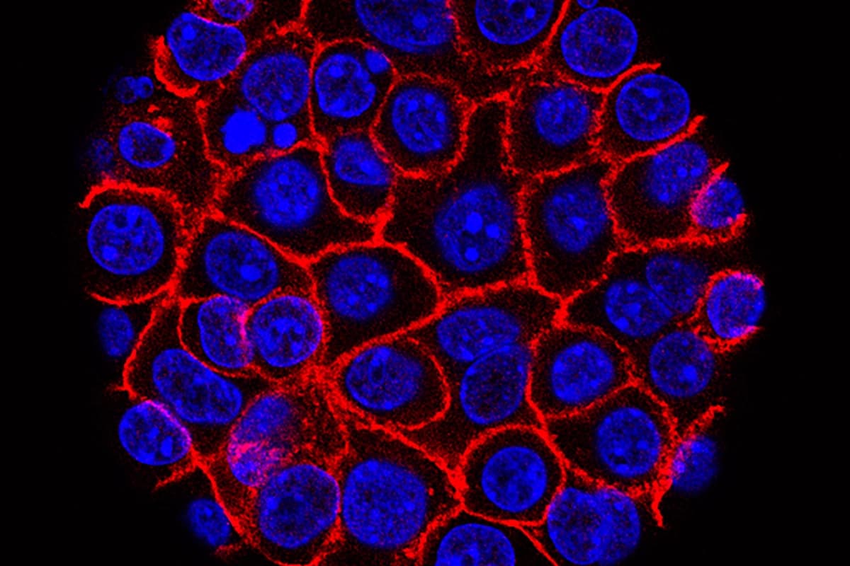 Células de cáncer de páncreas, núcleos en azul, creciendo como una esfera rodeada de membranas rojas. (Min Yu/Centro Eli y Edythe Broad para Medicina Regenerativa e Investigación con Células Madre en la USC, Centro Oncológico Integral USC Norris).