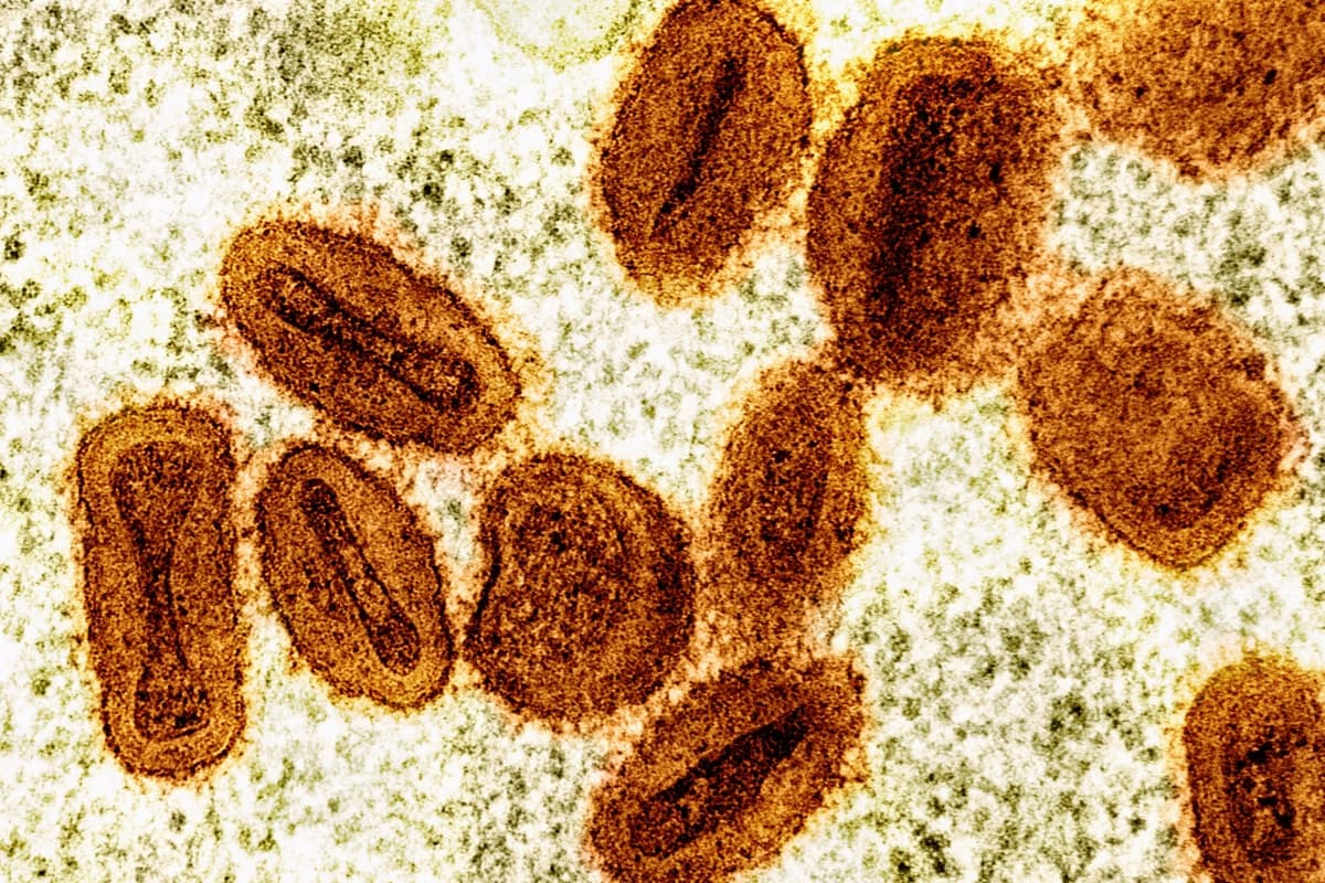 Una imagen coloreada tomada con microscopio electrónico muestra partículas del virus de la viruela del simio, en naranja, dentro de células infectadas, en verde. (NIAID vía AP)