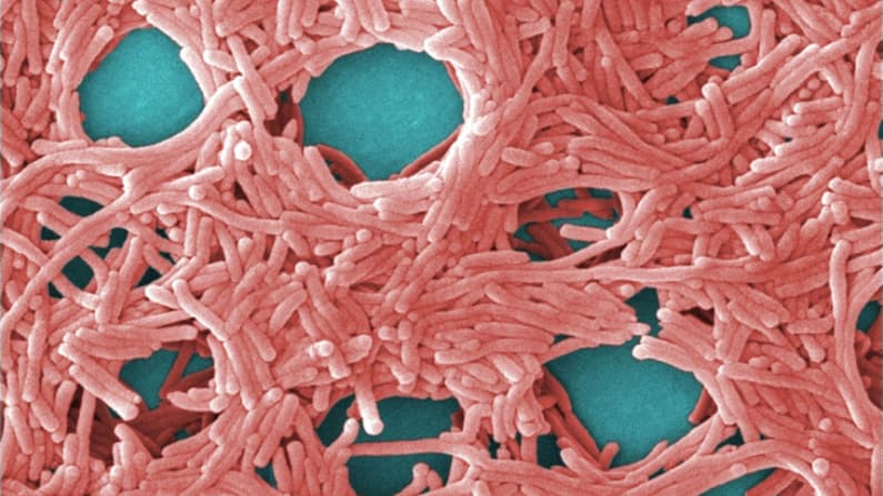 CDC advierten que el manejo inadecuado de la leche en polvo para bebés provocaría enfermedades graves