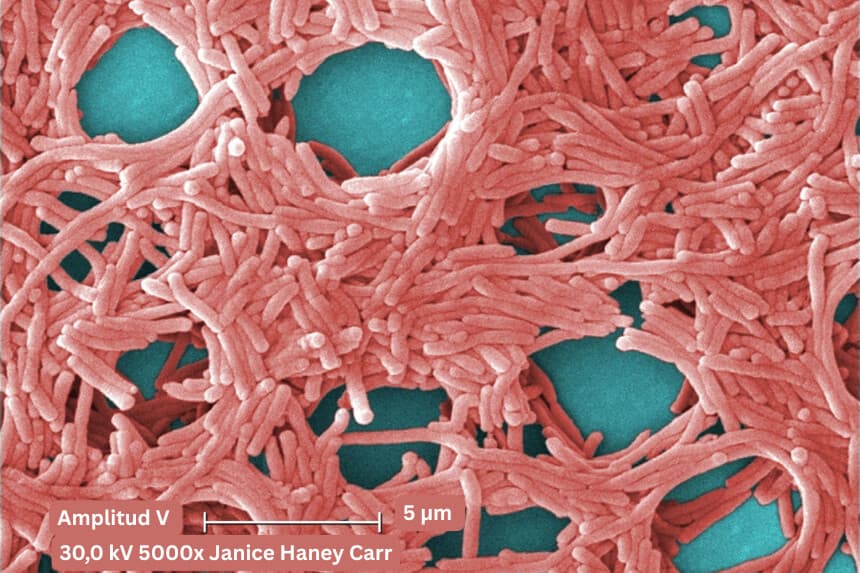 Micrografía electrónica de barrido (SEM) coloreada de la bacteria Legionella pneumophila. (Janice Haney Carr/CDC/Dominio público).