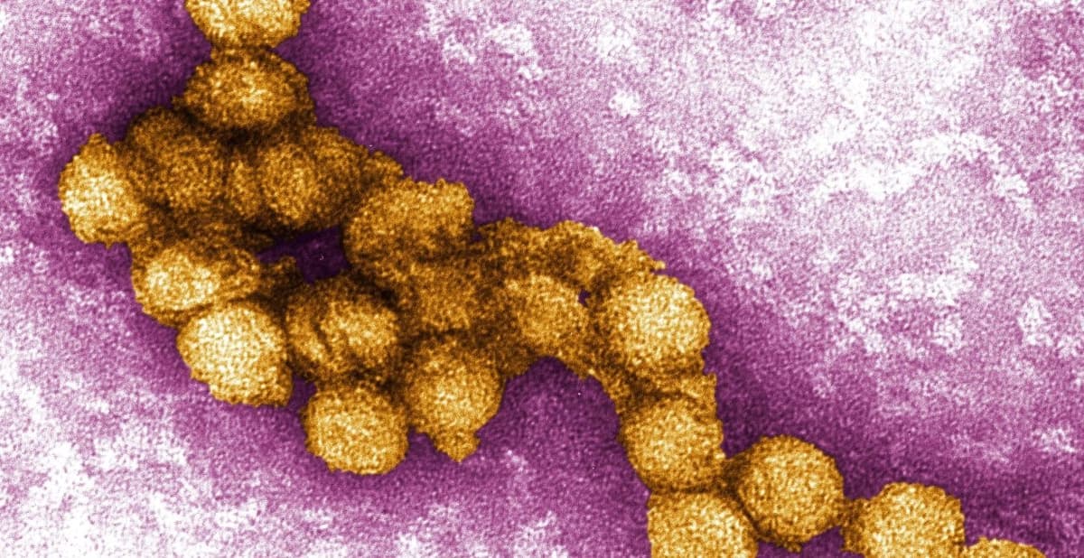 Una micrografía del virus del Nilo Occidental en una foto de 2014. (Cynthia Goldsmith, P.E. Rollin, Centros para el Control y la Prevención de Enfermedades de EE. UU.)