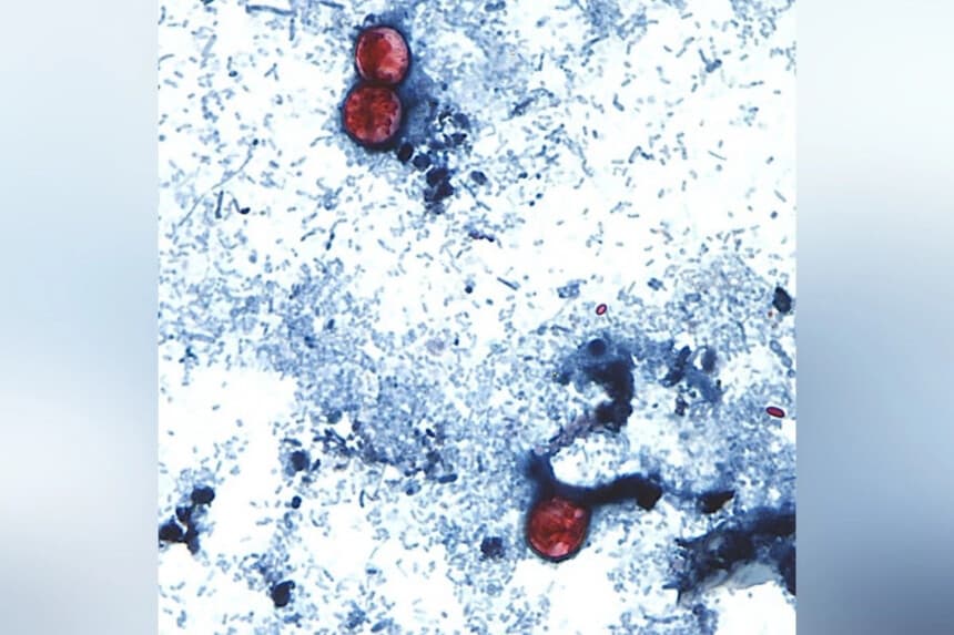 Esta fotografía sin fecha, tomada a través de un microscopio facilitado por los CDC, muestra oocistos de Cyclospora cayetanensis encontrados en una muestra de heces recientes. (CDC vía AP).