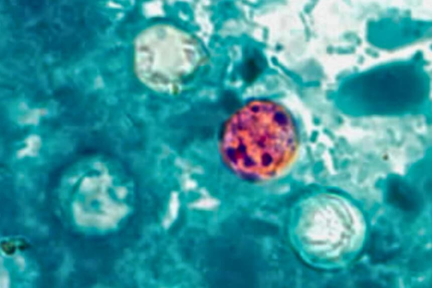 Oocistos de Cyclospora cayetanensis en una muestra de heces, en una imagen de archivo sin fecha. (CDC vía The Epoch Times).