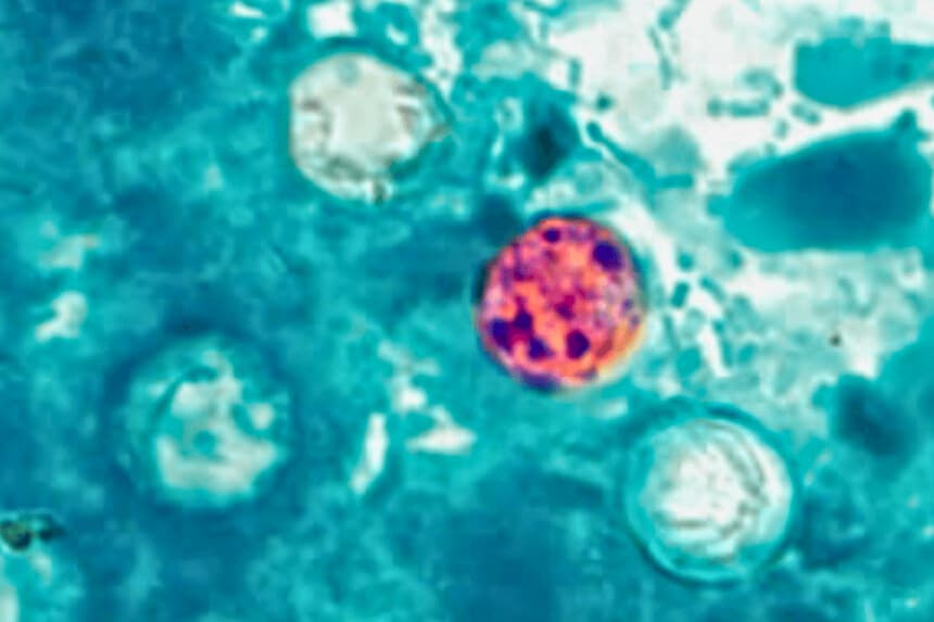 Oocistos de Cyclospora cayetanensis en una muestra de heces, en una imagen de archivo sin fecha. (CDC, vía The Epoch Times).