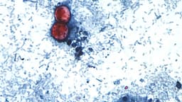 Alertan por enfermedad causada por parásito Cyclospora, ya está presente en 45 estados: CDC